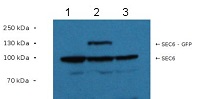 Sec6 | Exocyst complex subunit in the group Antibodies Plant/Algal / Membrane Transport System / Plasma membrane at Agrisera AB (Antibodies for research) (AS13 2686)